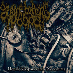 Gruesome Bodyparts Autopsy : Hepatobiliopancreatic Procedures Gruesome Bodyparts Autopsy : Hepatobiliopancreatic Procedures